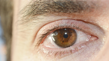 CBO analisa estudo sobre nova abordagem para hipotonia ocular e reforça necessidade de cautela